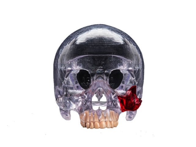 A clear medical model 3D-printed with PLASTCure Clear 200 resin. (Image courtesy of Prodways.)
