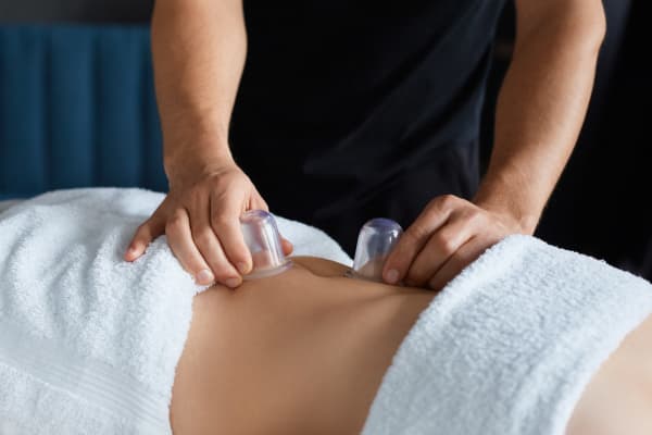 Cupping Therapy