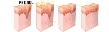 Retinol anti-oxidant demonstration of effects retinolthumb