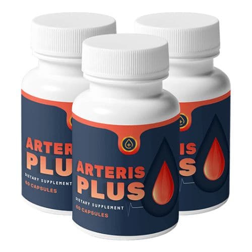 Arteris Plus