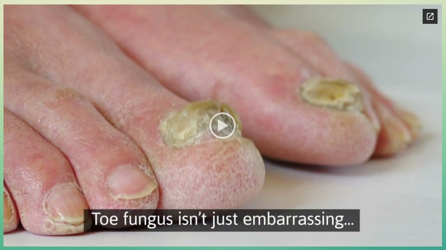 ANTI FUNGAL FOOT CARE SERUM