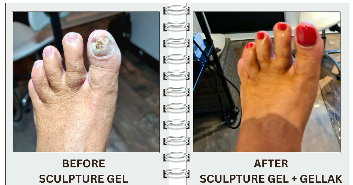 Voor en na: nagelreparatie met sculpture gel, afgewerkt met gellak