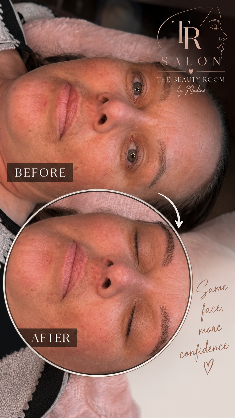 Voor en na een behandeling bij The Beauty Room by Nadine: same face, more confidence