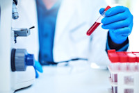 Roche, Eli Lilly team up on Alzheimer's biomarker blood test