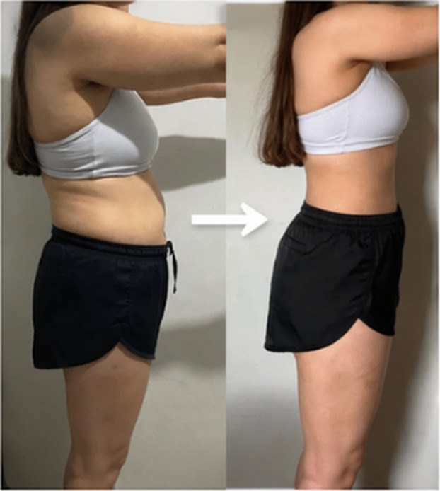 Before and after