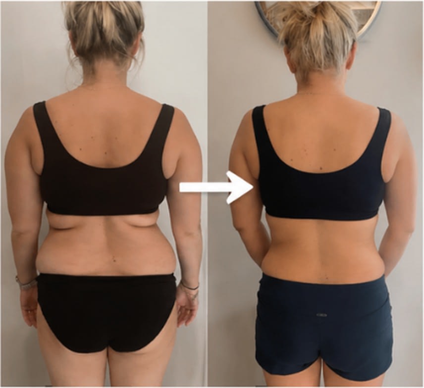 Before and after