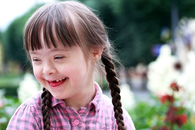 Pro-life advocates defend unborn babies with Down syndrome after YouTuber goes public with abortion