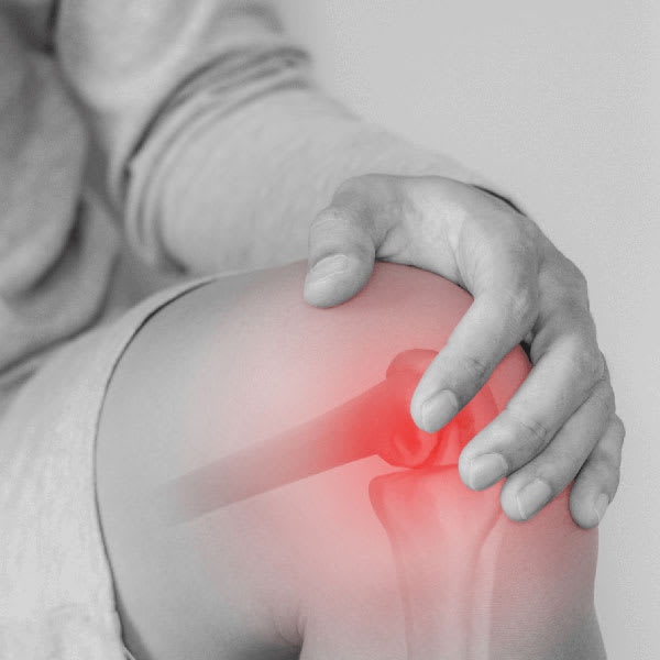 Illustration of knee pain