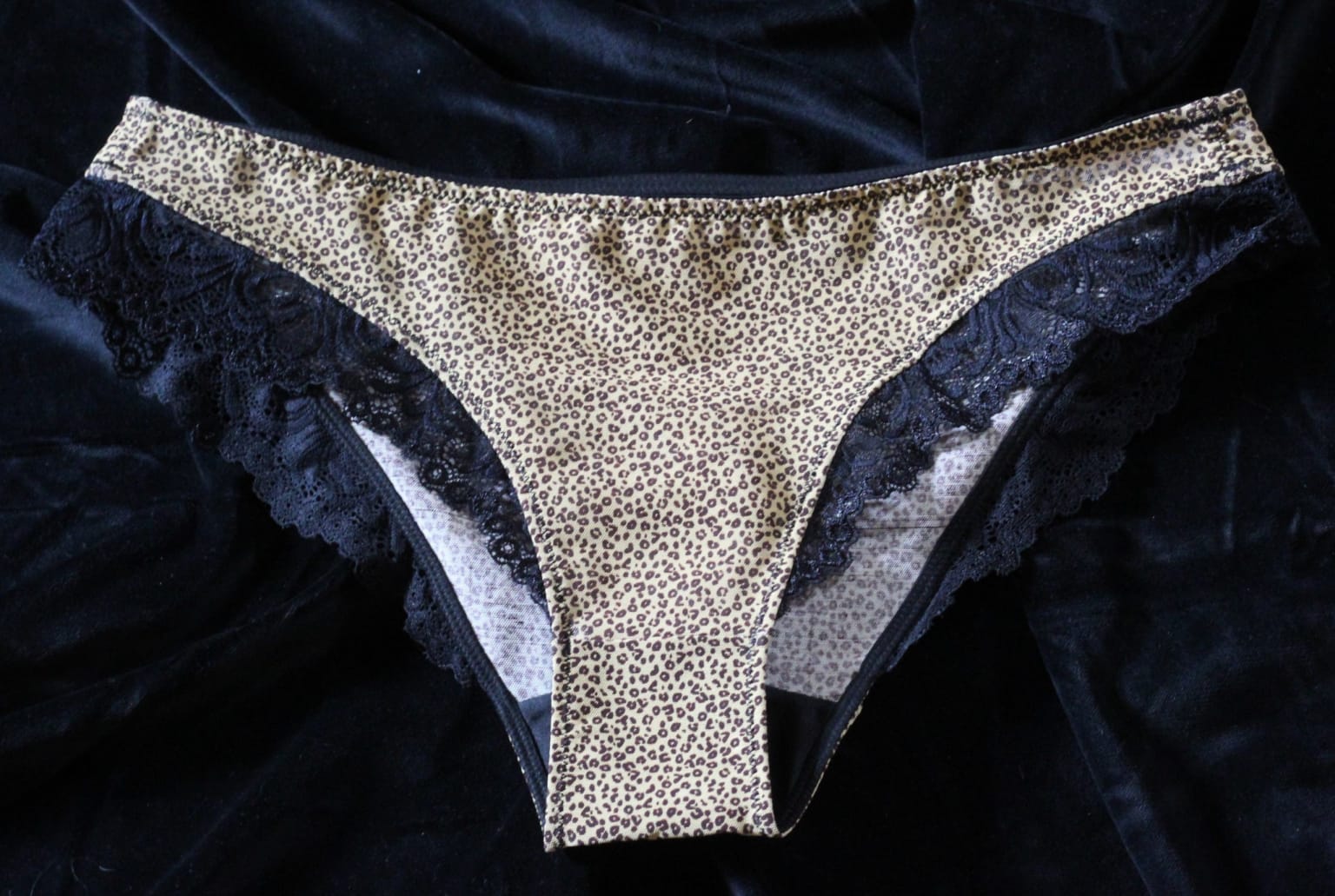 Postpartum briefs review