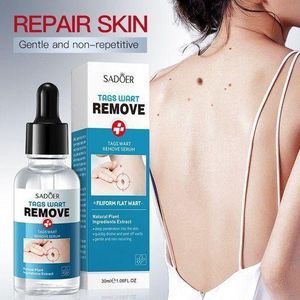 Tags Wart Remove