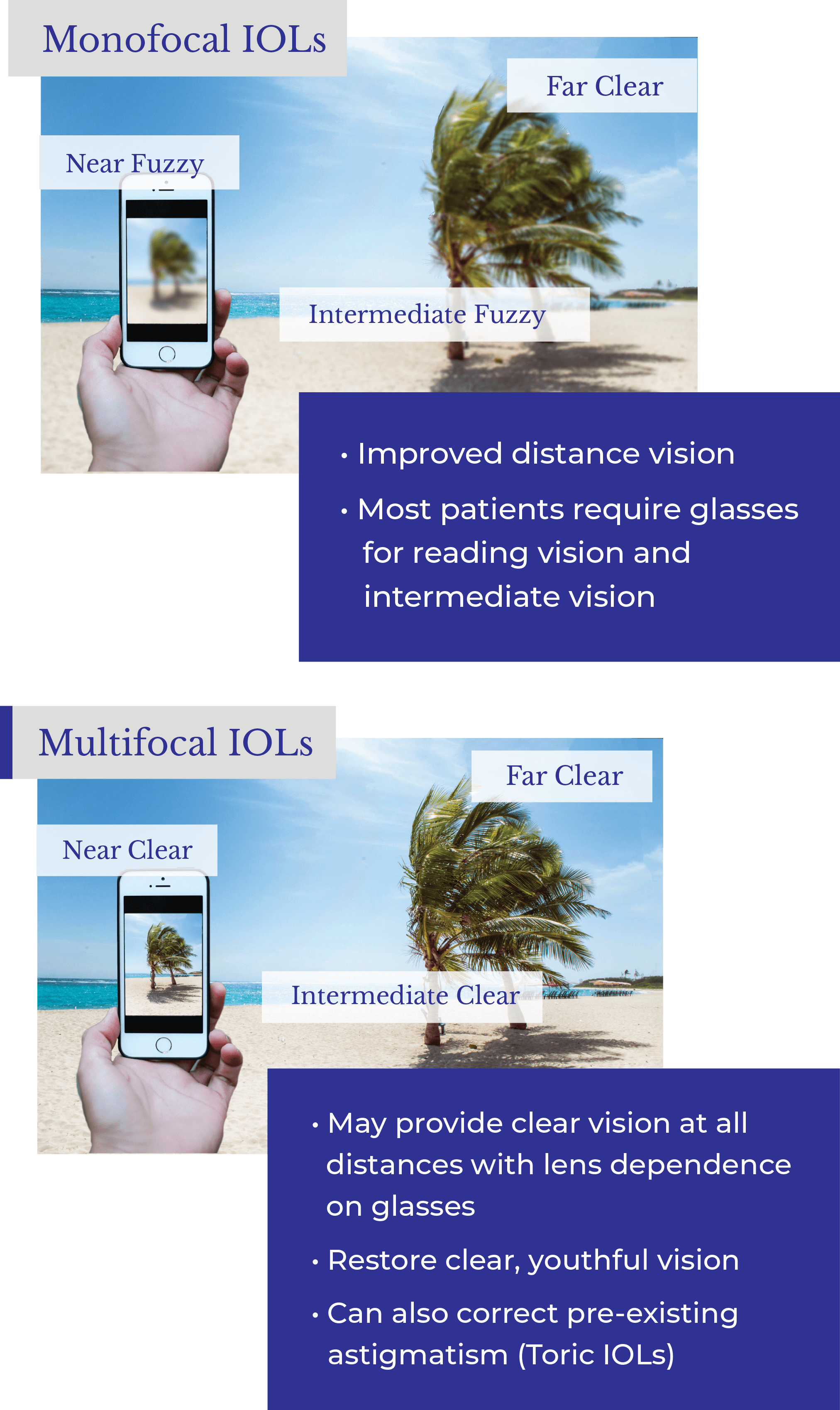 Cataract Consultation Checklist cataract-consultation-checklist