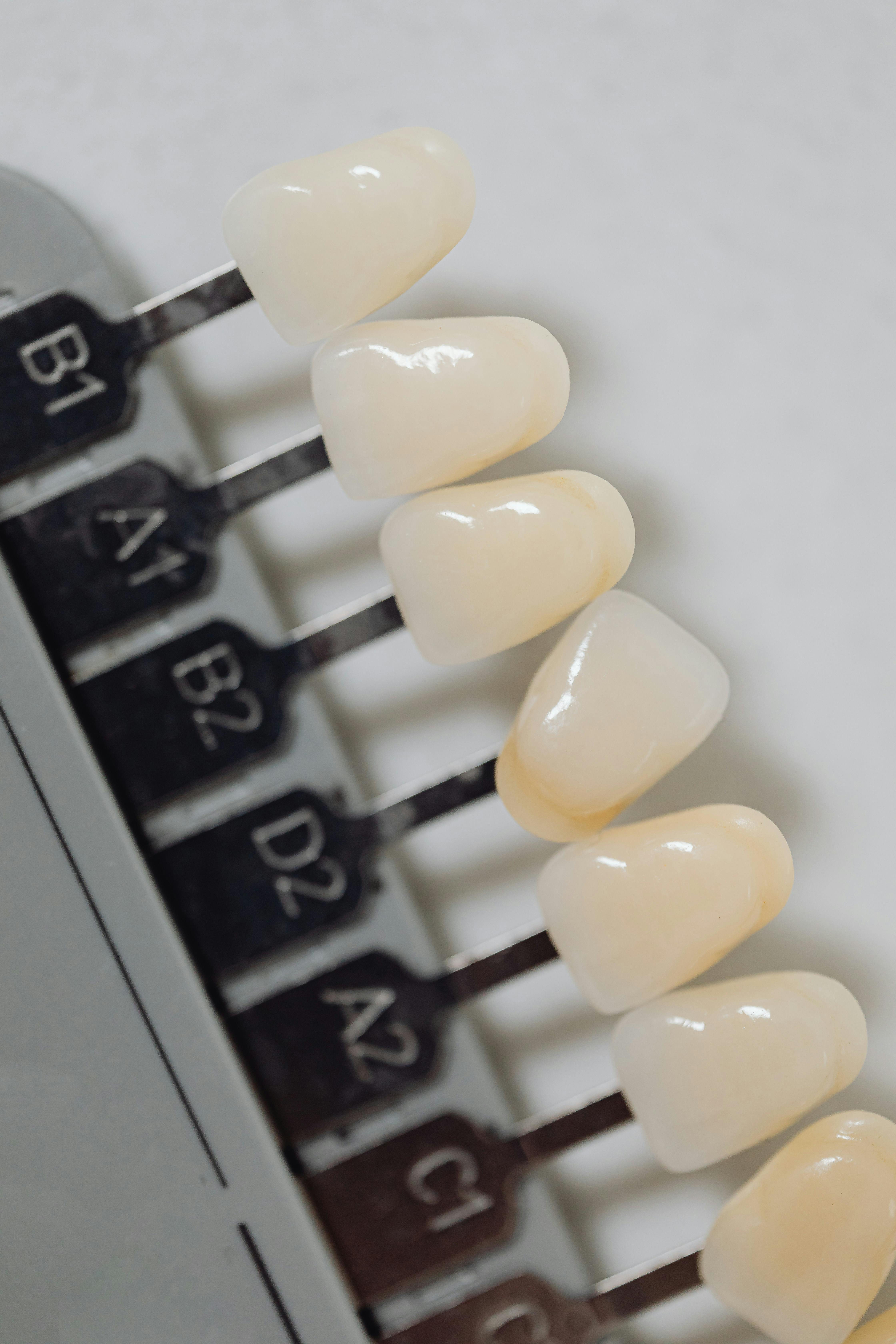 Veneer application process