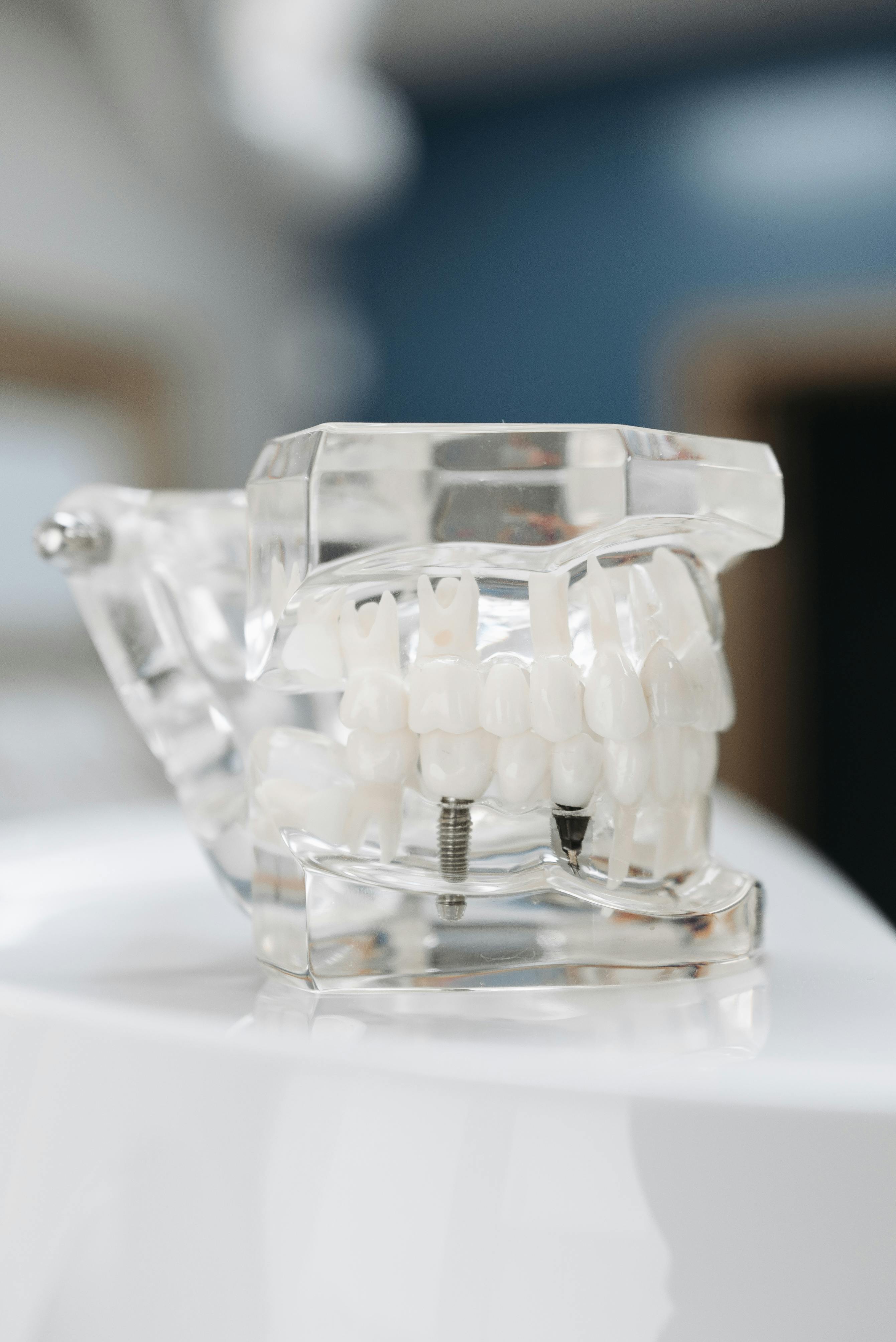Implant placement