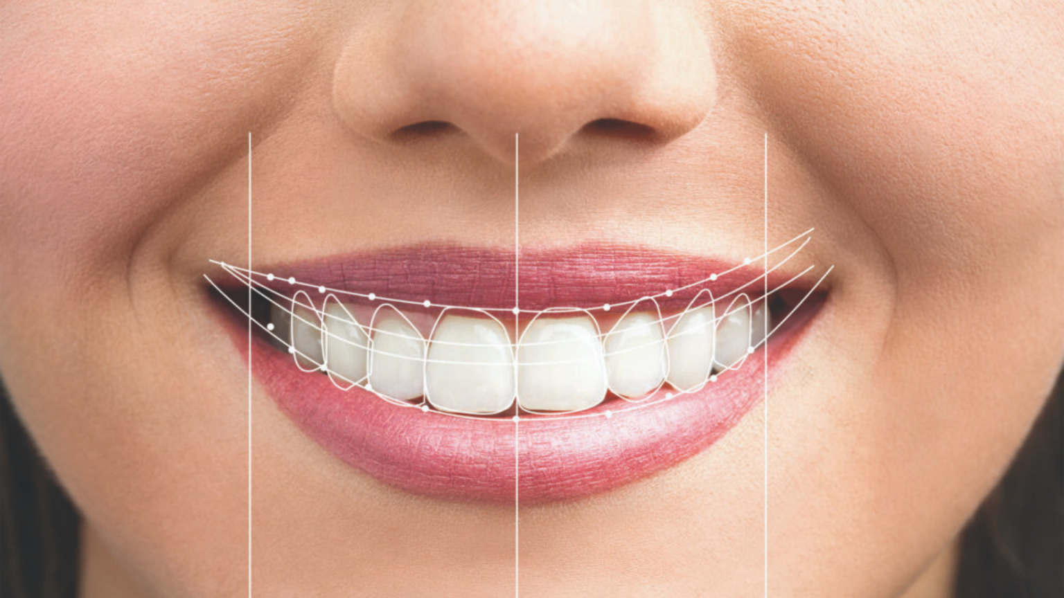 Smile Design digital planning