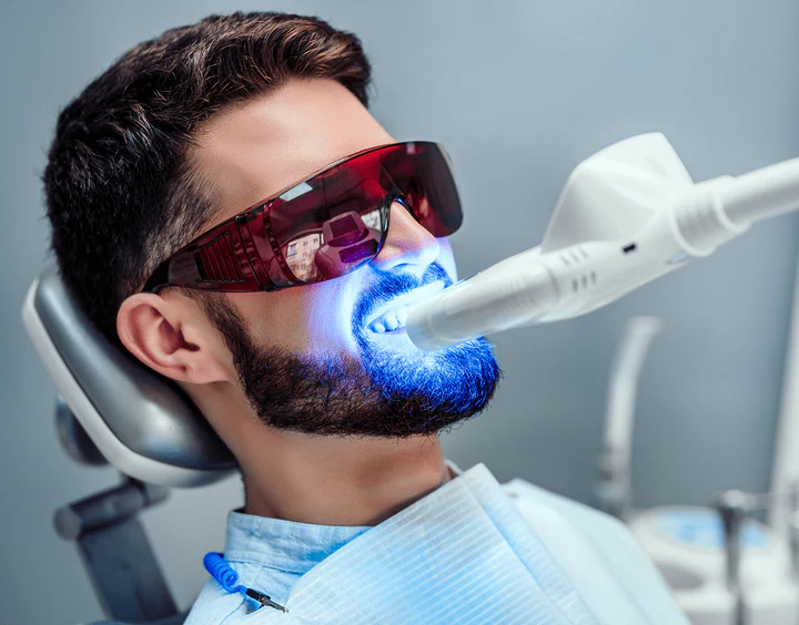 Laser teeth whitening vs bleaching