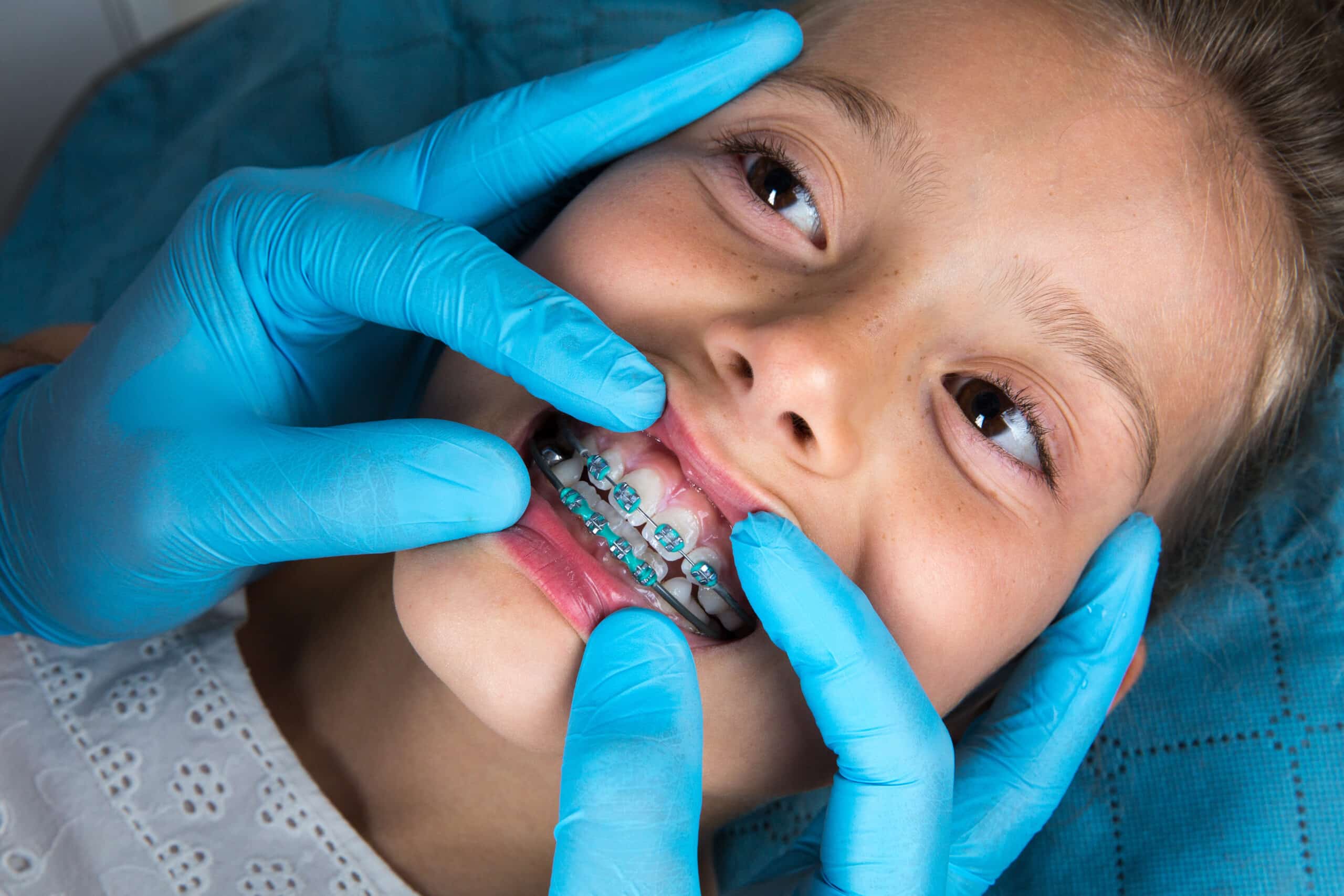 Orthodontics results