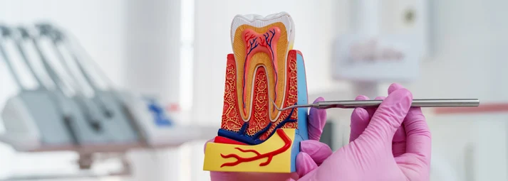 Root Canal (Endodontics)