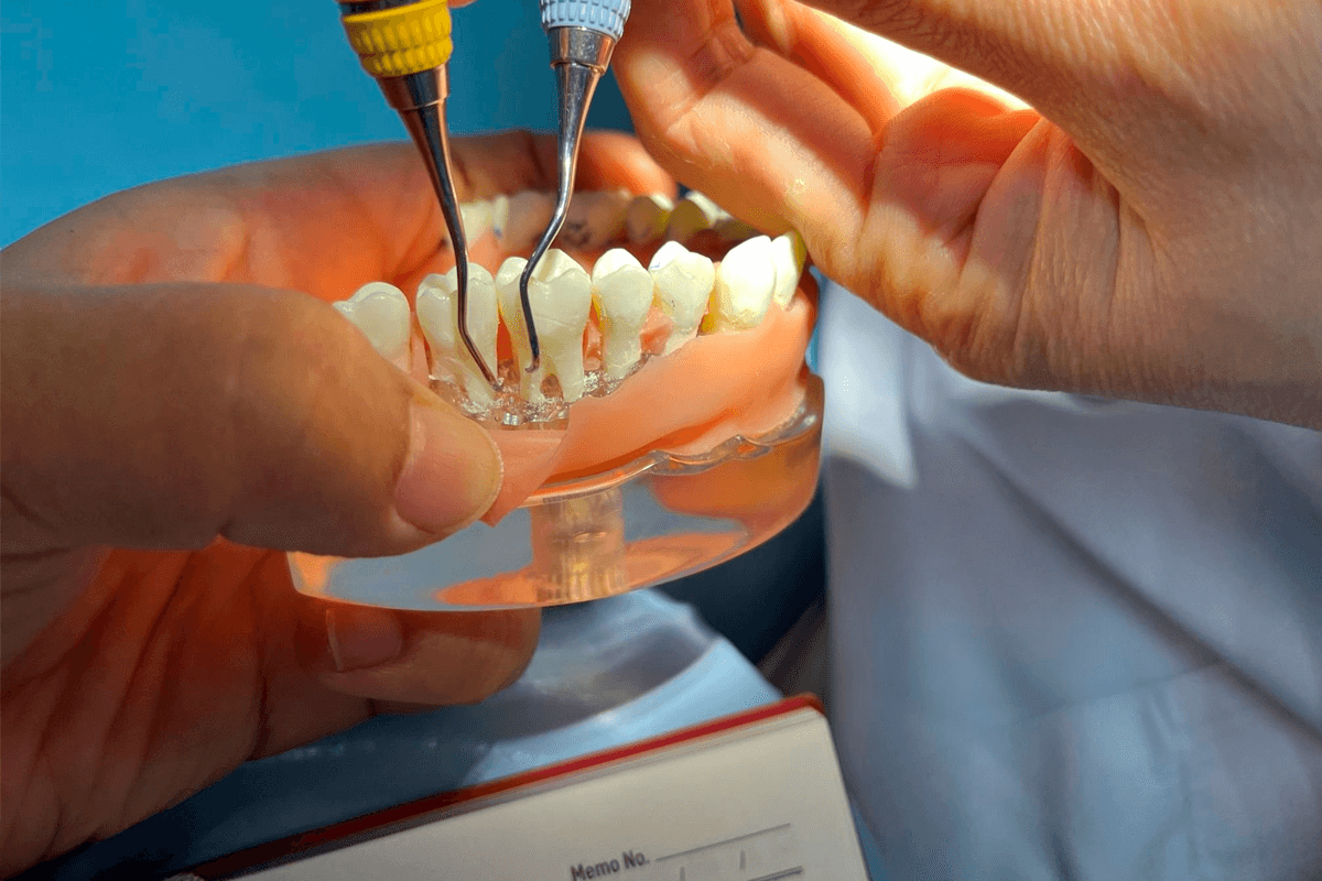 When is a root canal necessary