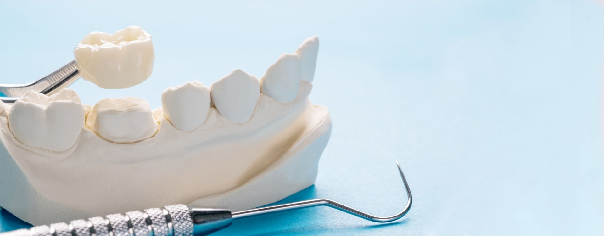 Dental Crowns