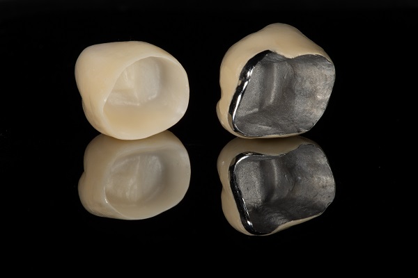 Dental crown procedure