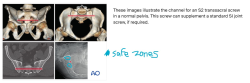 Attachment thumbnail