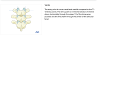 Attachment thumbnail