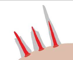 Attachment thumbnail