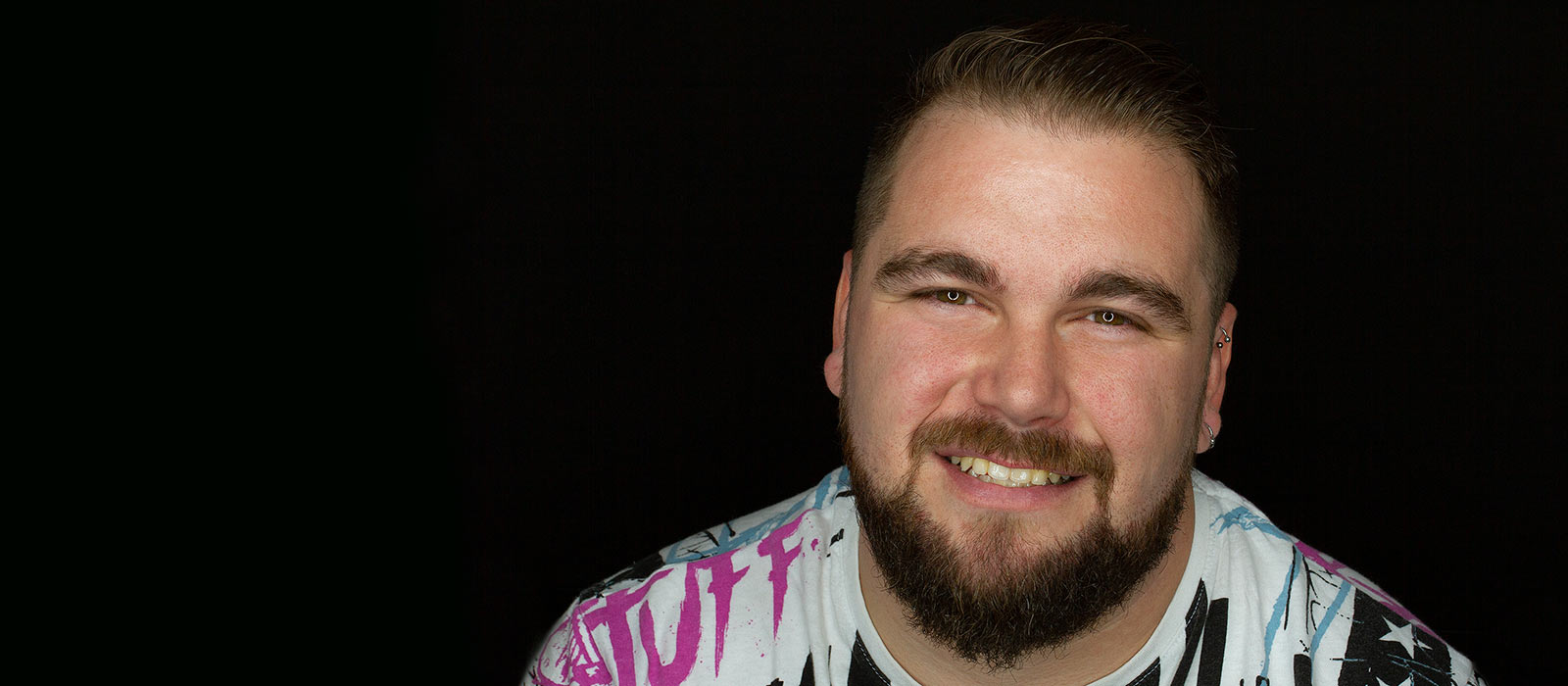 Experiencia de ortodoncia con Invisalign y carillas dentales en Madrid