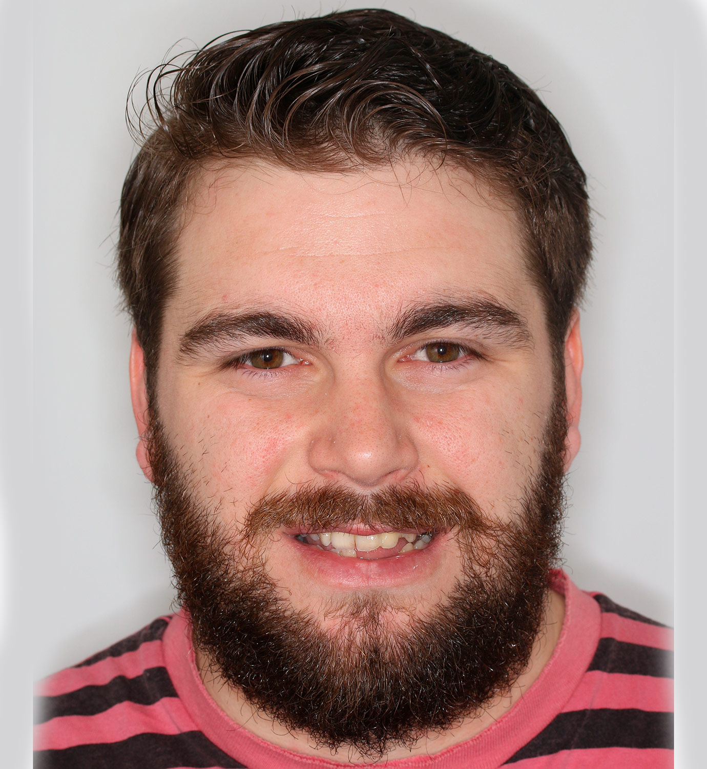 fotografía de sonrisa antes de ortodoncia