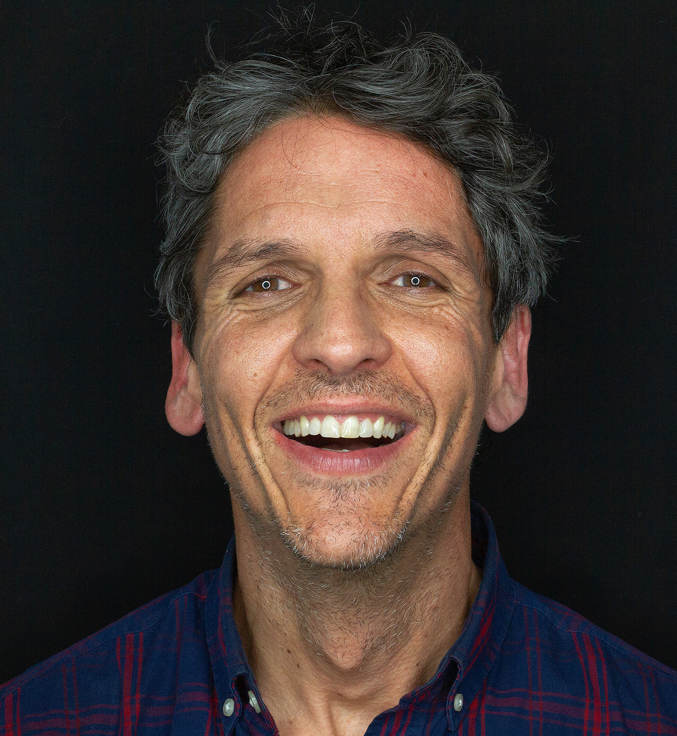 fotografía de después