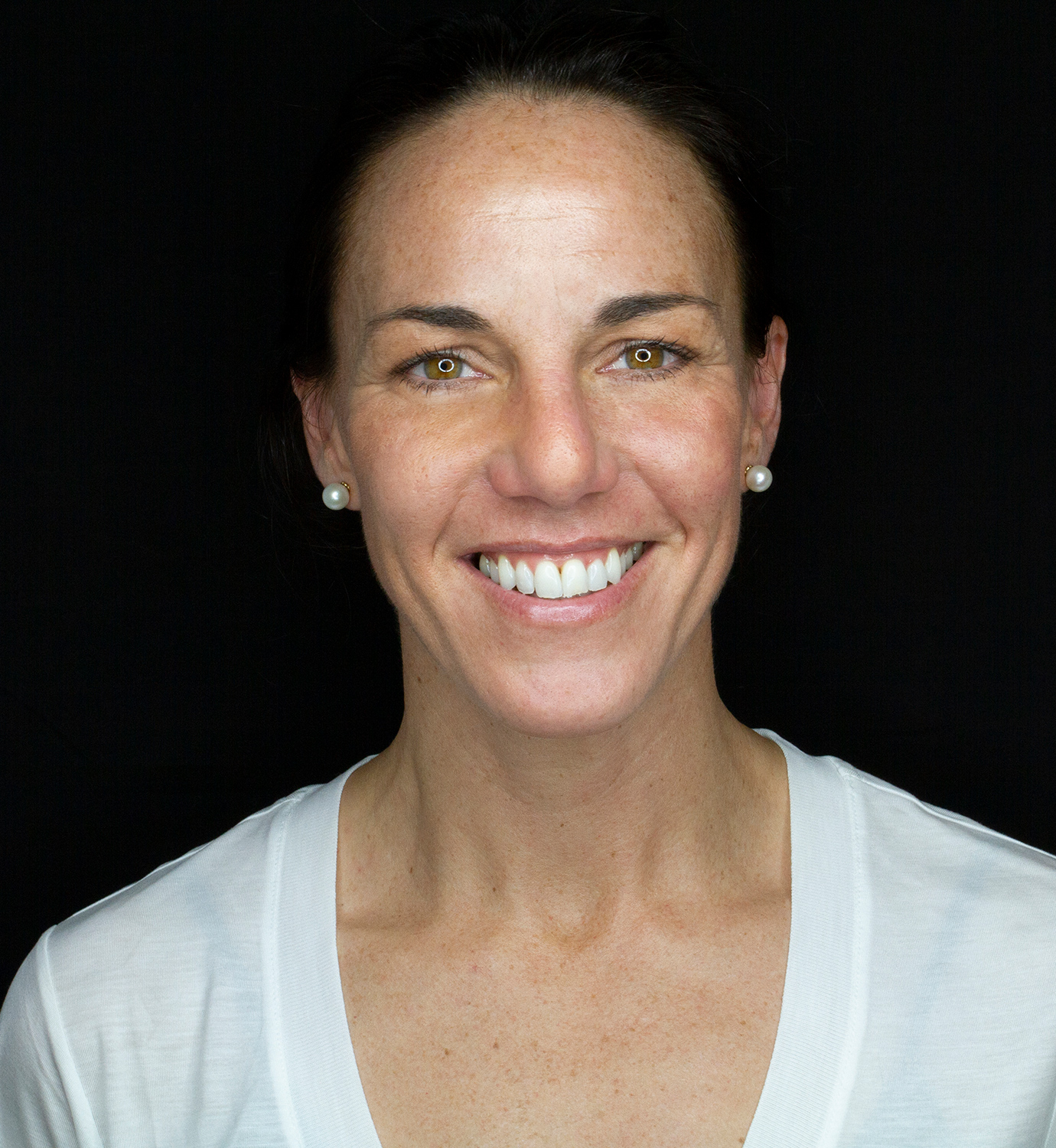 fotografía de sonrisa después del blanqueamiento