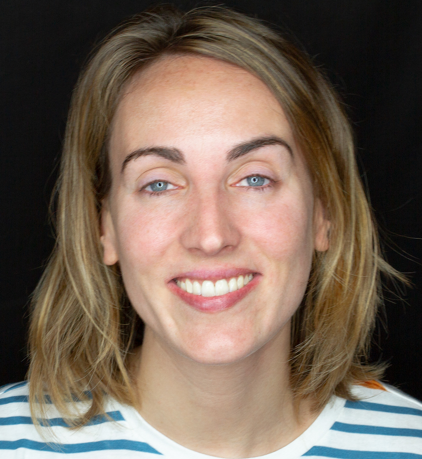 fotografía de después de ortodoncia con Invisalign