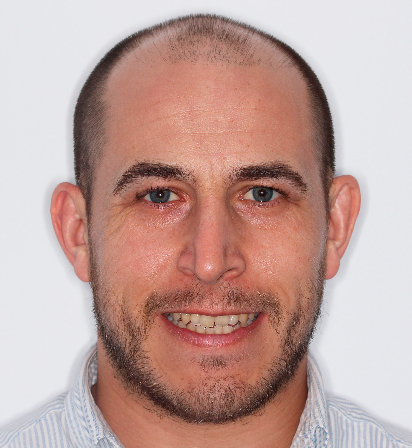 fotografía de antes