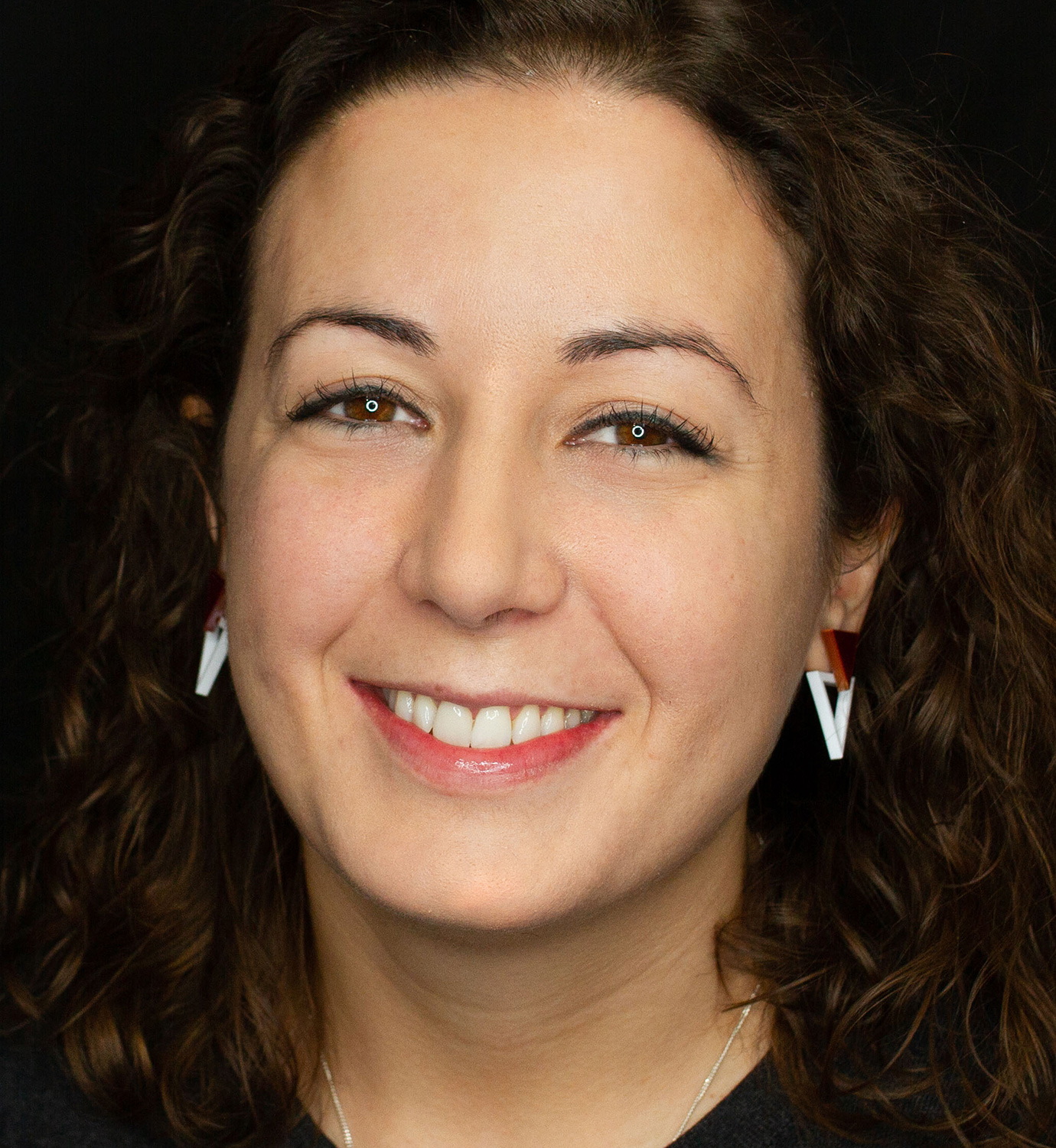 fotografía de después de Invisalign Full