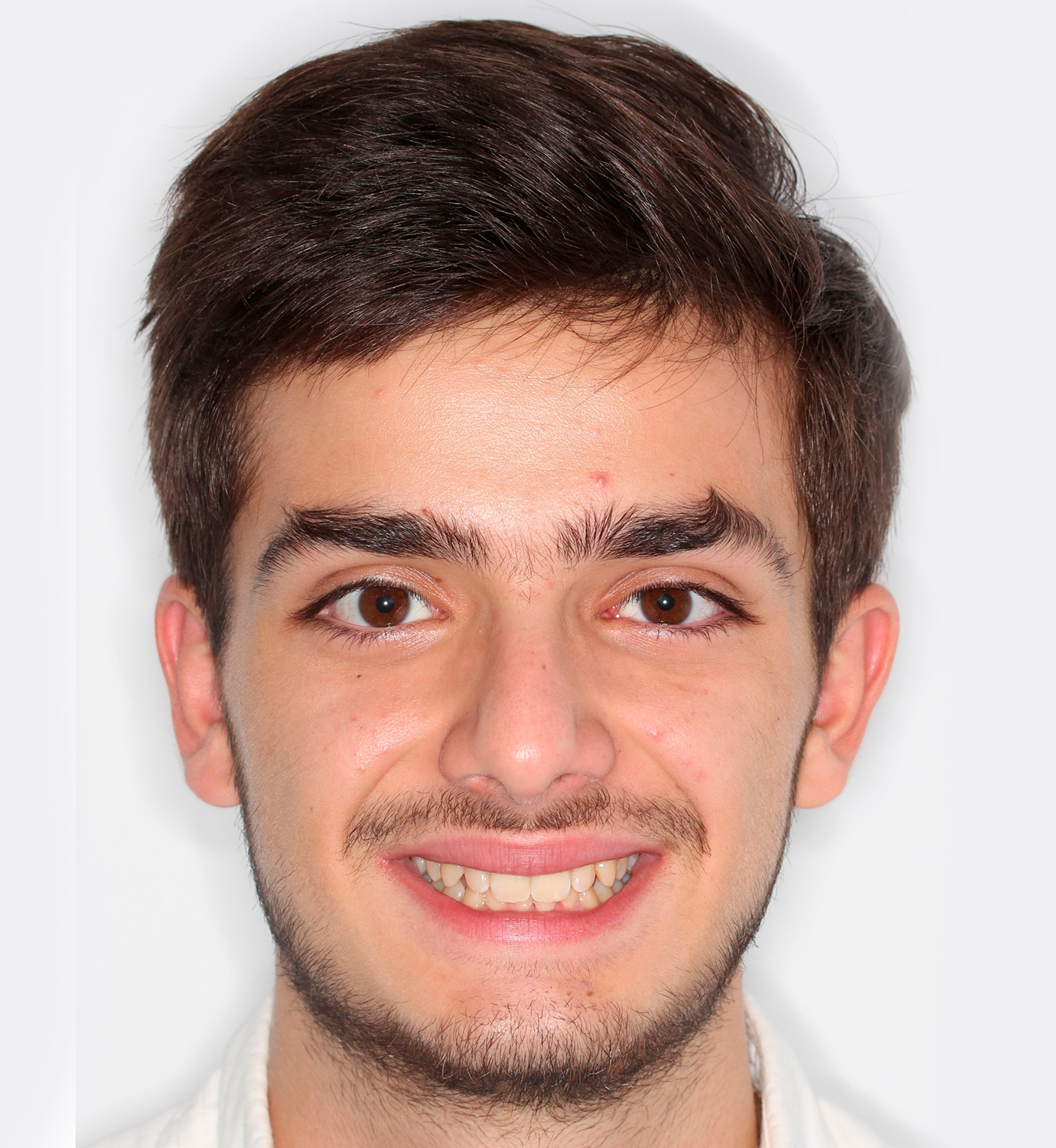 fotografía de antes