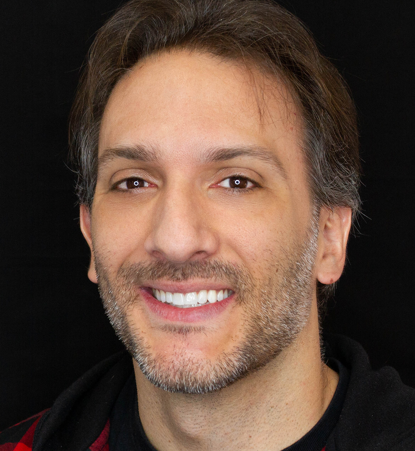 fotografía de después