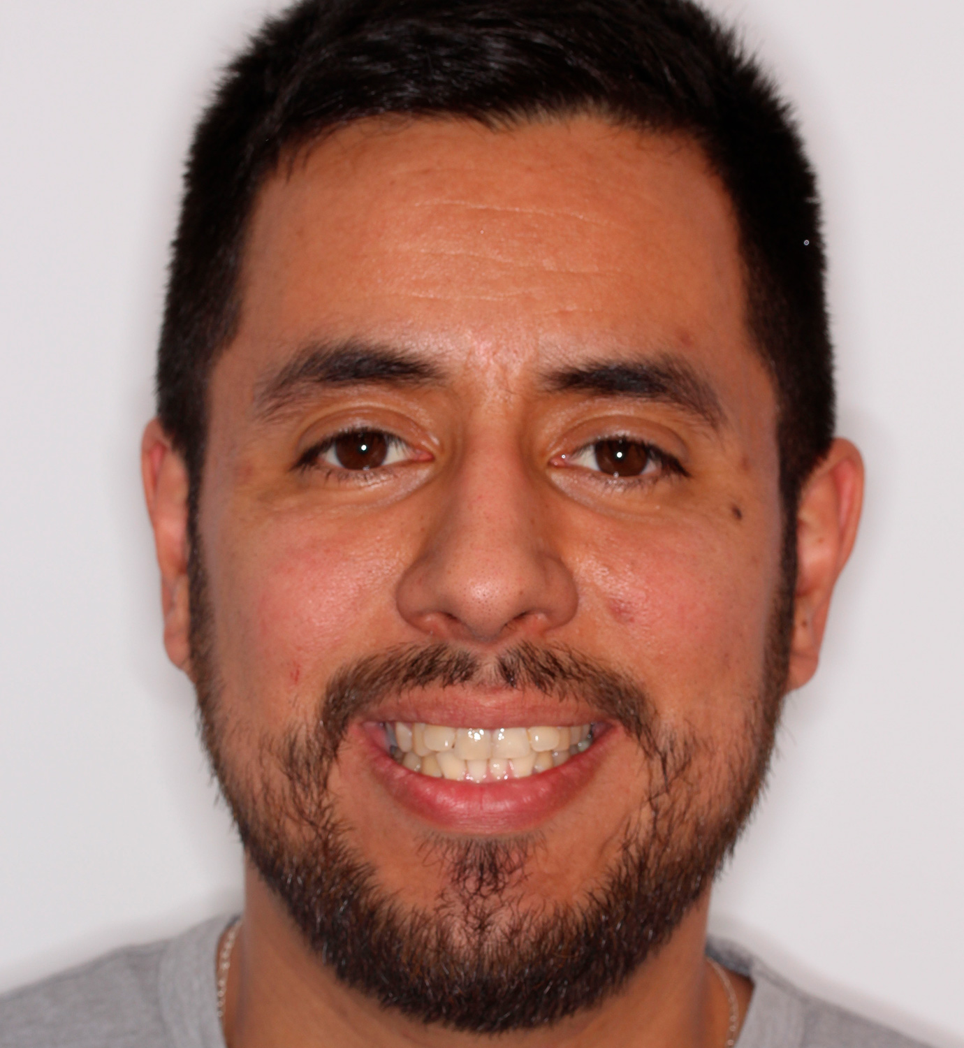 fotografía de antes