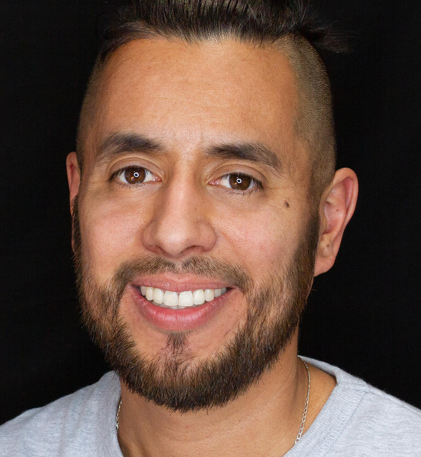 fotografía de después