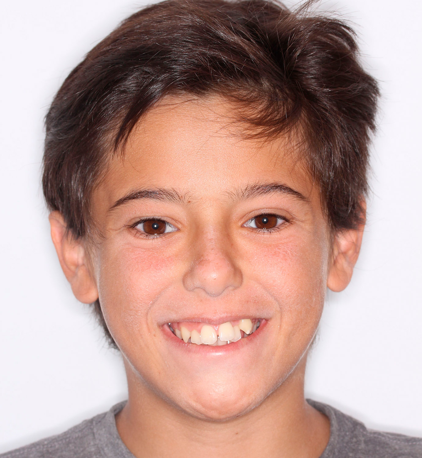 fotografía de antes