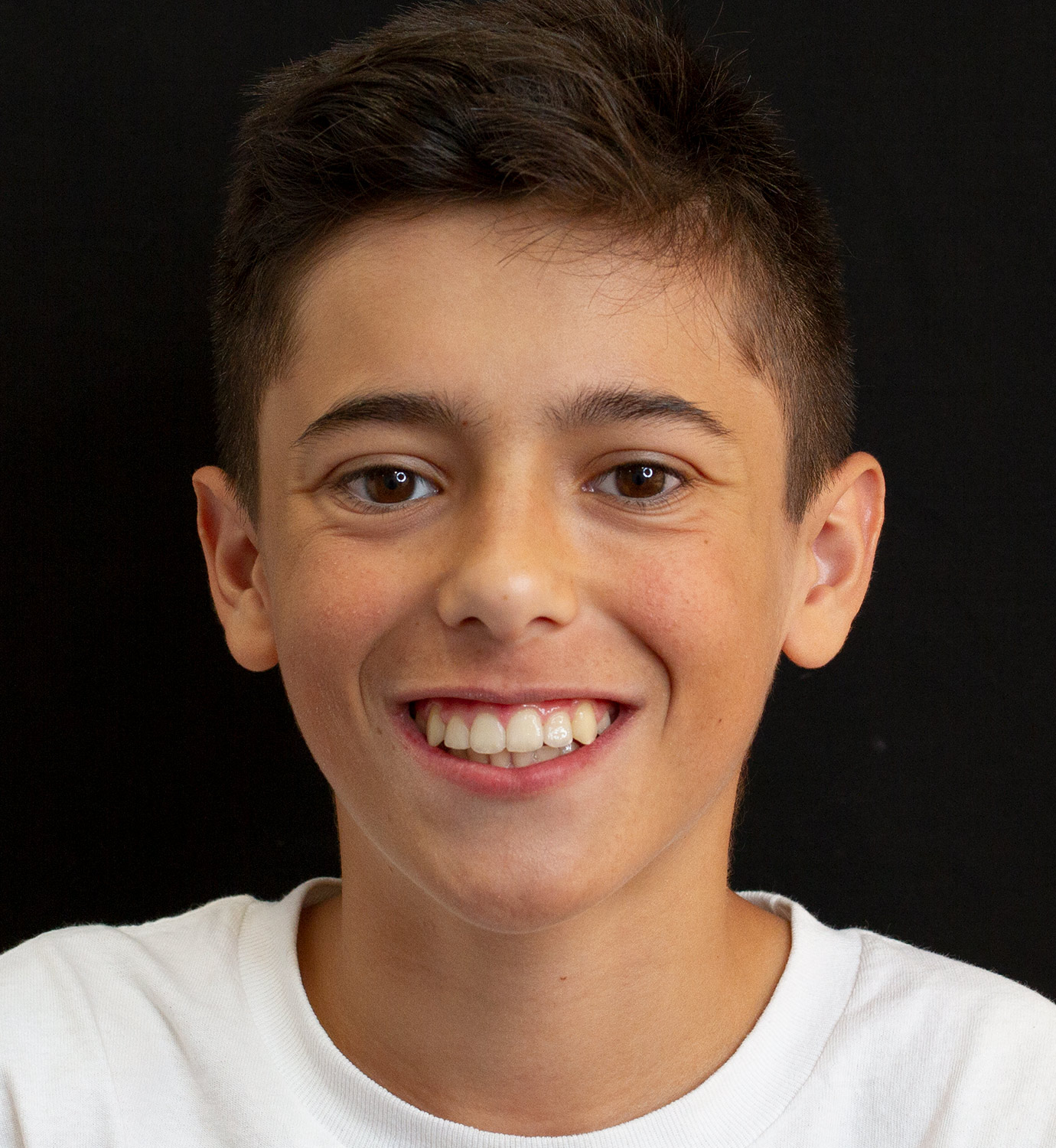 fotografía de después