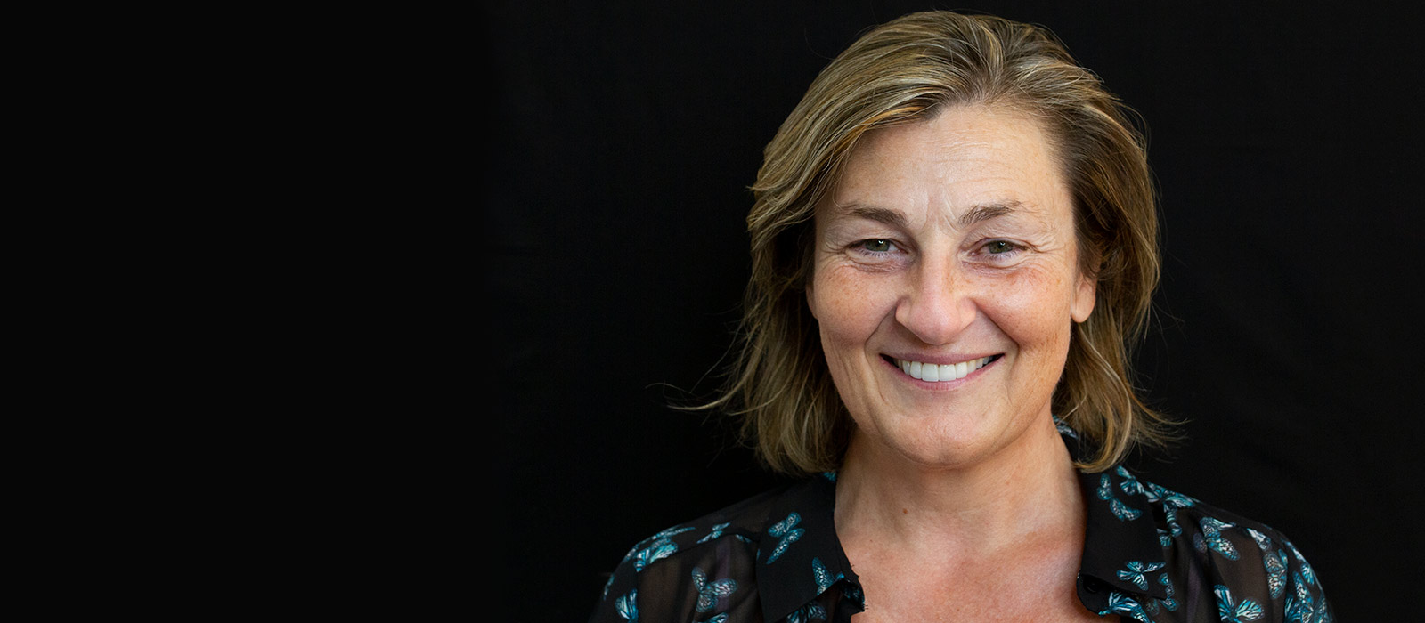 Experiencia de ortodoncia con brackets maetálicos y carillas dentales en Madrid