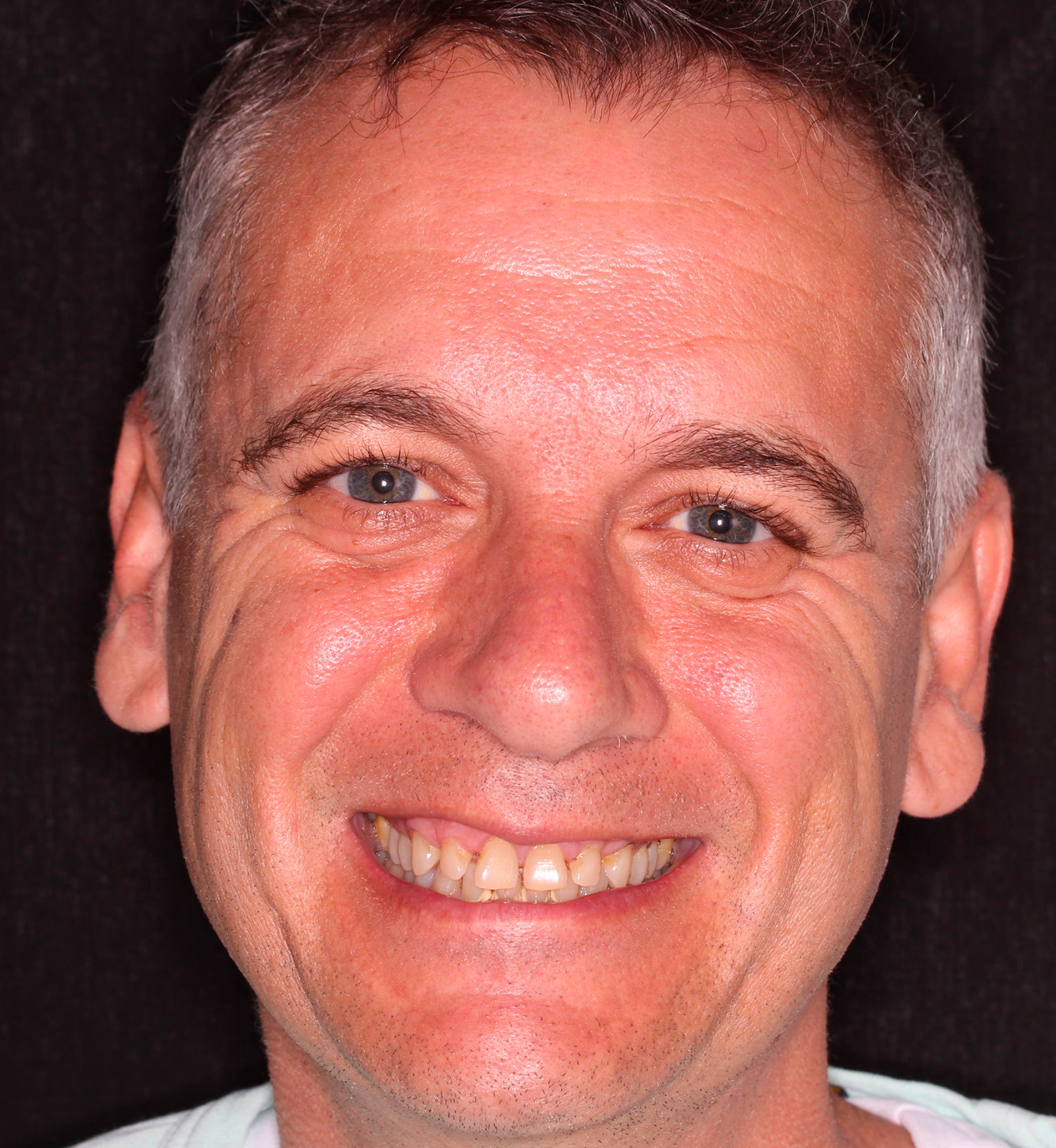 fotografía de antes