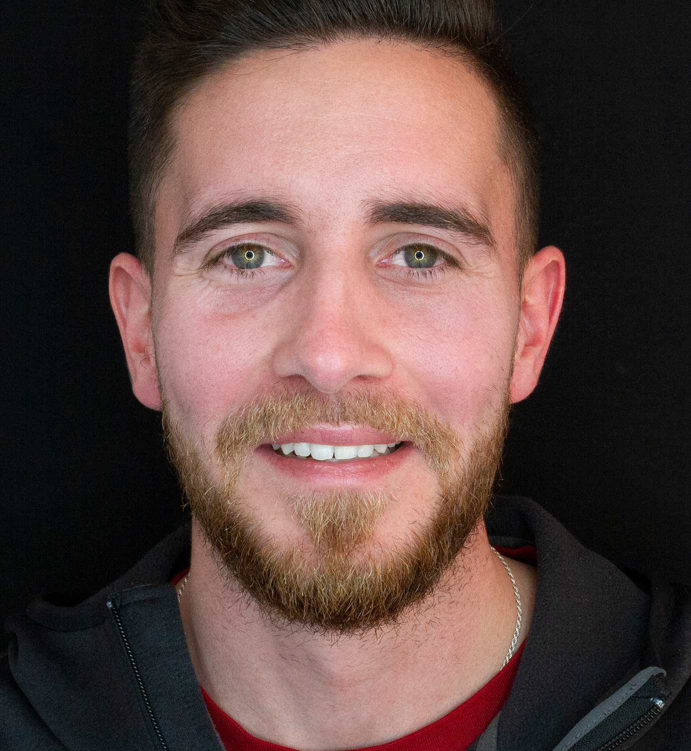 fotografía de después