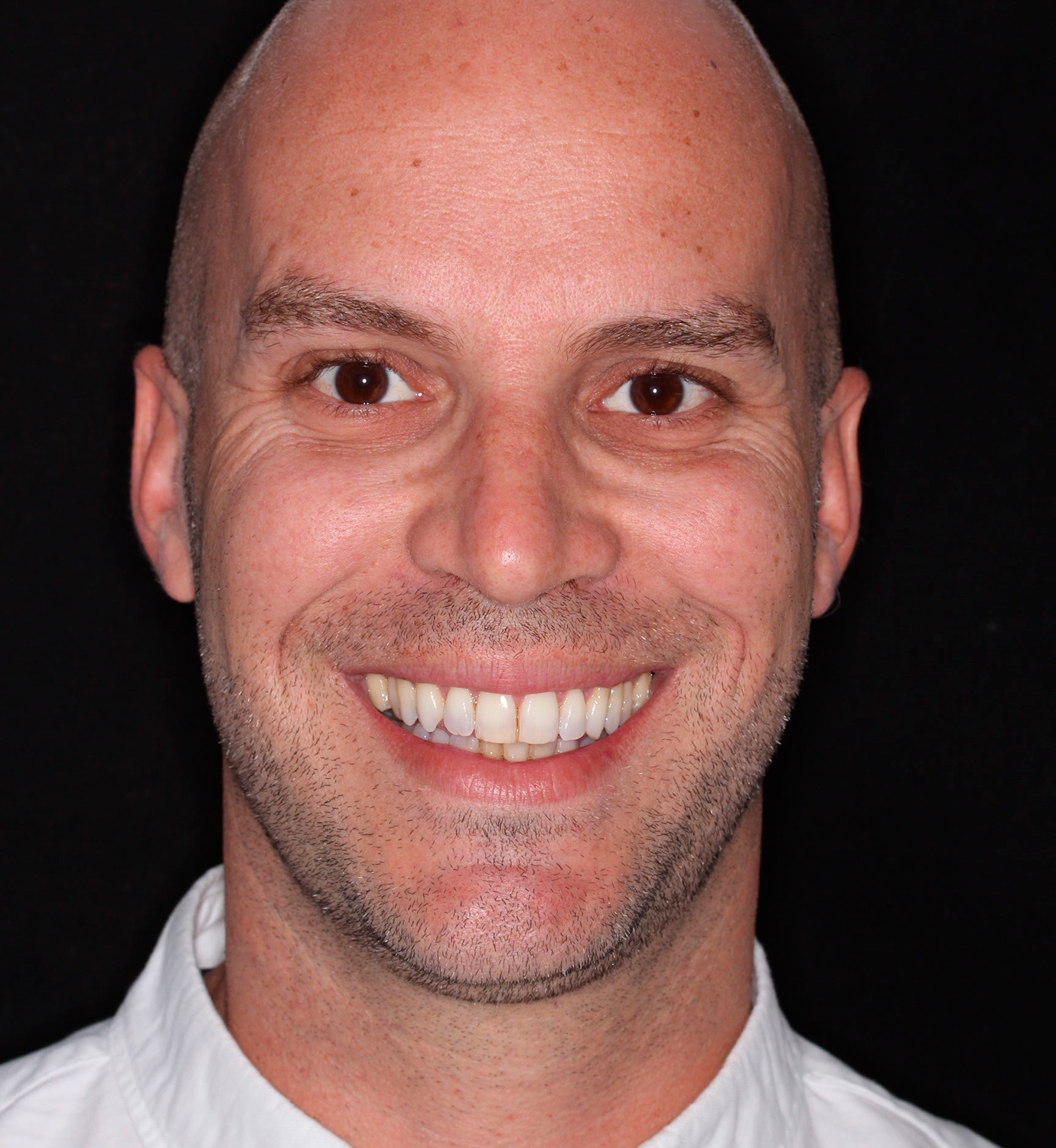 fotografía de antes