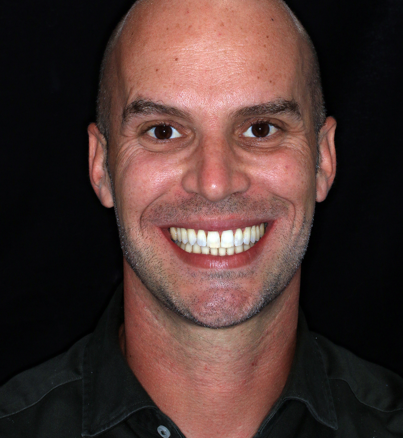 fotografía de después