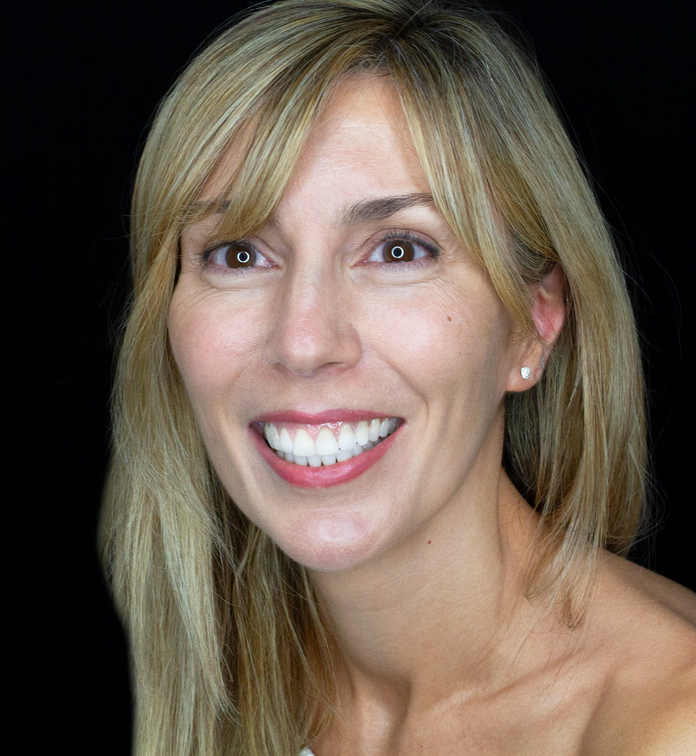 fotografía de después de ortodoncia con Invisalign