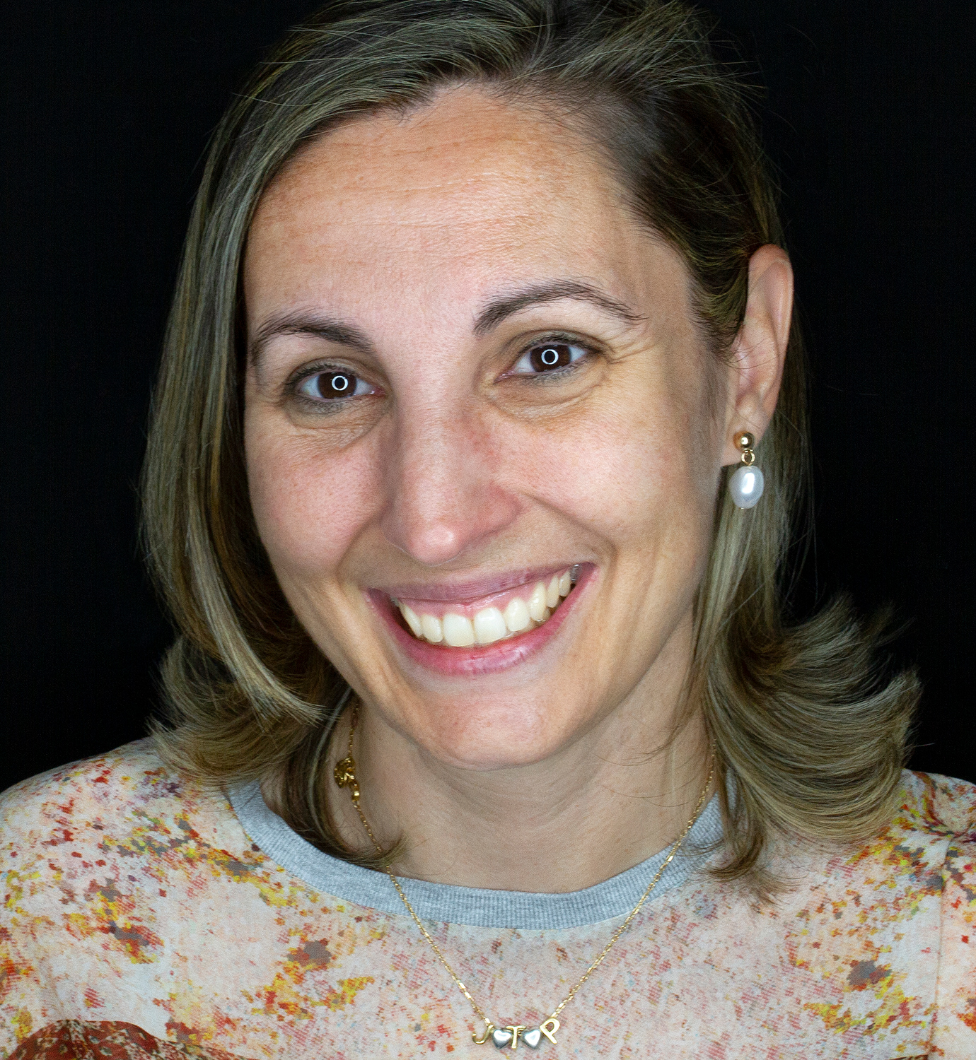 fotografía de después de ortodoncia con Invisalign