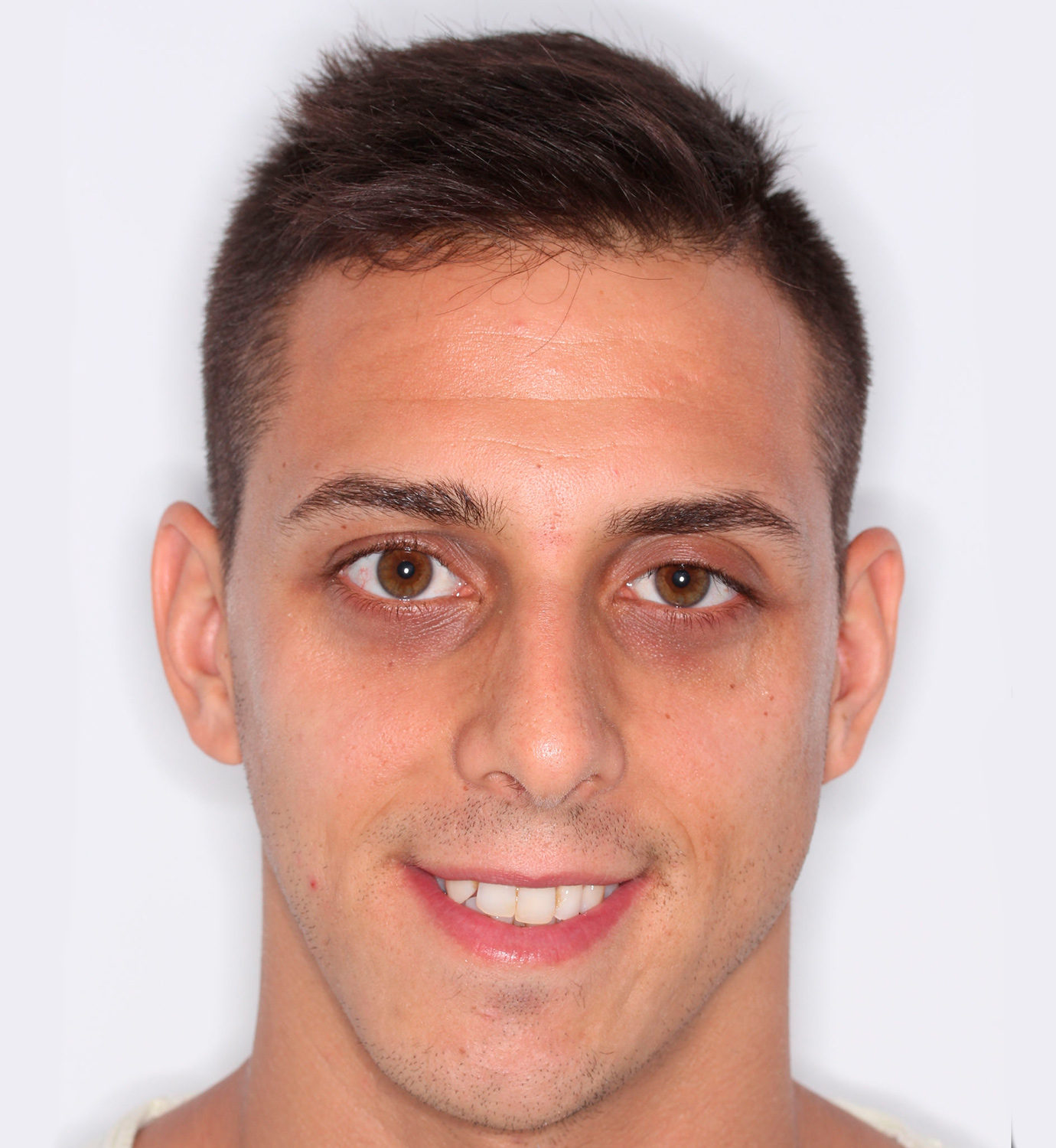 fotografía de antes