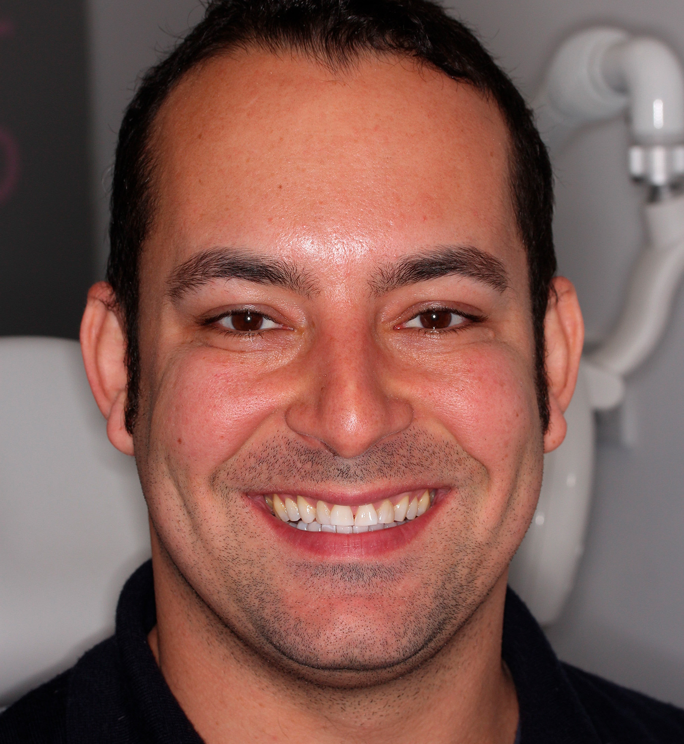 fotografía de antes