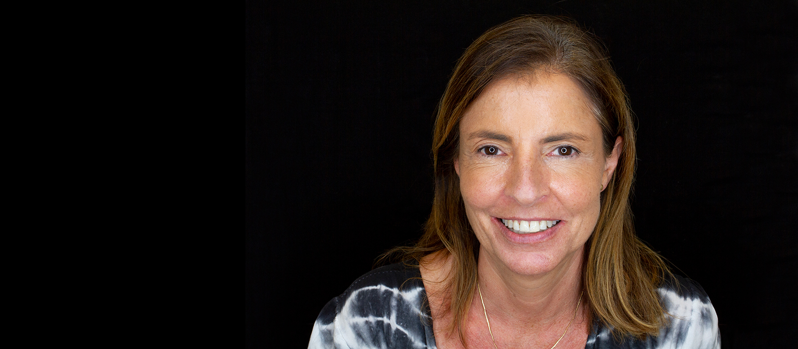 Experiencia de ortodoncia con Invisalign